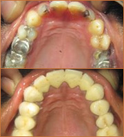 smile zone